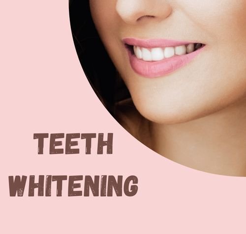 Teeth Whitening